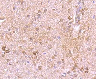 Immunohistochemistry-Paraffin: Kv1.4 Antibody [NBP2-75552] - Analysis of paraffin-embedded rat brain tissue using anti-Kv1.4 antibody. Counter stained with hematoxylin.