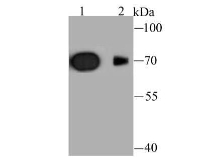 Western Blot: Kv1.4 Antibody [NBP2-75552] - Analysis of Kv1.4 on rat brain (1) and mouse brain (2) tissue lysate using anti-Kv1.4 antibody at 1/1,000 dilution.