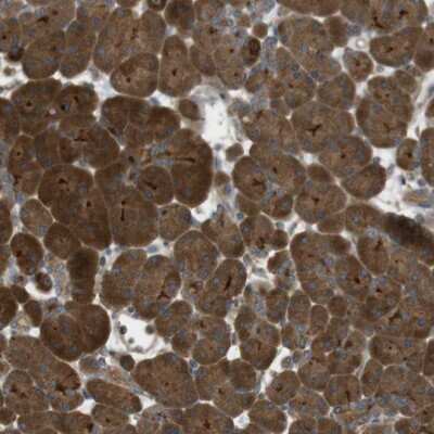 Immunohistochemistry-Paraffin: Kv1.6 Antibody [NBP1-89717] - Staining of human pancreas shows moderate cytoplasmic positivity.