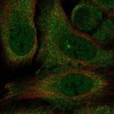 Immunocytochemistry/ Immunofluorescence Kv10.2 Antibody - BSA Free