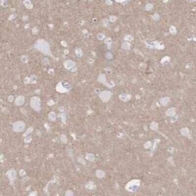 Immunohistochemistry-Paraffin: Kv11.2 Antibody [NBP3-17875] - Staining of human cerebral cortex shows moderate positivity in neuropil.