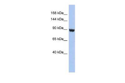 Western Blot: Kv11.2 Antibody [NBP2-84124] - WB Suggested Anti-KCNH6 Antibody Titration: 0.2-1 ug/ml. ELISA Titer: 1:312500. Positive Control: HT1080 cell lysate