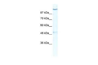 Western Blot: Kv11.2 Antibody [NBP2-84126] - WB Suggested Anti-KCNH6 Antibody Titration: 0.2-1 ug/ml. ELISA Titer: 1:12500. Positive Control: HepG2 cell lysate