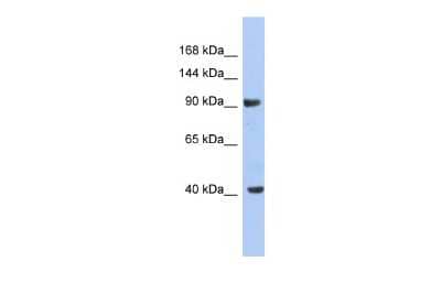 Western Blot: Kv11.2 Antibody [NBP2-84127] - WB Suggested Anti-KCNH6 Antibody Titration: 0.2-1 ug/ml. ELISA Titer: 1:312500. Positive Control: NCI-H226 cell lysateKCNH6 is strongly supported by BioGPS gene expression data to be expressed in NCI-H226