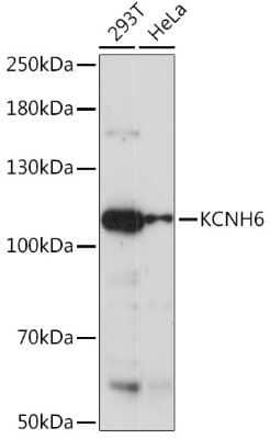 Western Blot: Kv11.2 Antibody [NBP3-03792] - Western blot analysis of extracts of various cell lines, using Kv11.2 Rabbit pAb (NBP3-03792) at 1:1000 dilution. Secondary antibody: HRP Goat Anti-Rabbit IgG (H+L) at 1:10000 dilution. Lysates/proteins: 25ug per lane. Blocking buffer: 3% nonfat dry milk in TBST. Detection: ECL Enhanced Kit (RM00021). Exposure time: 60s.