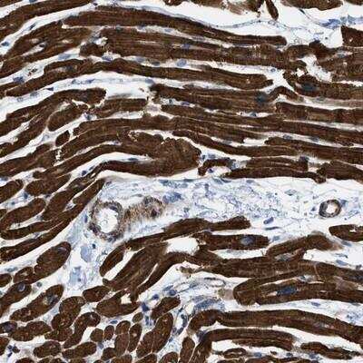 Immunohistochemistry-Paraffin: Kv11.3 Antibody [NBP1-84813] - Staining of human heart muscle shows strong cytoplasmic positivity in myocytes.