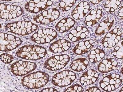 Immunohistochemistry-Paraffin: Kv11.3 Antibody [NBP3-06083] - Immunochemical staining of human Kv11.3 in human rectum with rabbit polyclonal antibody at 1:500 dilution, formalin-fixed paraffin embedded sections.