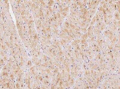 Immunohistochemistry-Paraffin: Kv11.3 Antibody [NBP3-06083] - Immunochemical staining of human Kv11.3 in cynomolgus heart with rabbit polyclonal antibody at 1:500 dilution, formalin-fixed paraffin embedded sections.