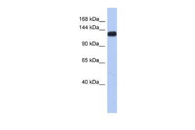 Western Blot: Kv11.3 Antibody [NBP2-85183] - WB Suggested Anti-KCNH7 Antibody Titration: 0.2-1 ug/ml. ELISA Titer: 1:312500. Positive Control: Human Small Intestine