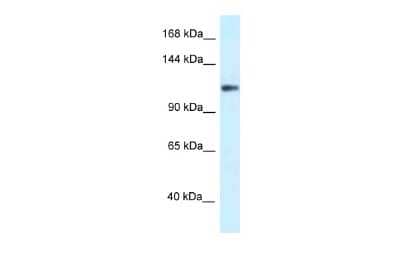 Western Blot: Kv12.2 Antibody [NBP2-85185] - WB Suggested Anti-KCNH3 Antibody. Titration: 1.0 ug/ml. Positive Control: COLO205 Whole Cell