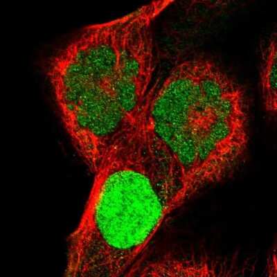 Immunocytochemistry/Immunofluorescence: Kv4.1 Antibody [NBP2-55128] - Staining of human cell line A-431 shows localization to nucleus.