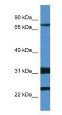 Western Blot: Kv4.1 Antibody [NBP1-74103] -  Mouse Spleen Lysate 1ug/ml Gel Concentration: 12%