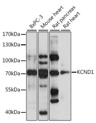 Western Blot: Kv4.1 Antibody [NBP3-03744] - Analysis of extracts of various cell lines, using Kv4.1 antibody at 1:1000 dilution. Secondary antibody: HRP Goat Anti-Rabbit IgG (H+L) at 1:10000 dilution. Lysates/proteins: 25ug per lane. Blocking buffer: 3% nonfat dry milk in TBST. Detection: ECL Basic Kit