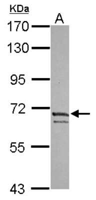 Western Blot: Kv4.3 Antibody [NBP2-19315] - Sample (30 ug of whole cell lysate) A: IMR32 7. 5% SDS PAGE gel, diluted at 1:1000.