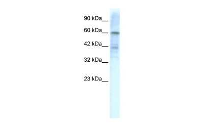 Western Blot: Kv4.3 Antibody [NBP2-87707] - WB Suggested Anti-KCND3 Antibody Titration: 1.25ug/ml. ELISA Titer: 1:12500. Positive Control: HepG2 cell lysate