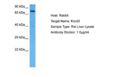 Western Blot: Kv4.3 Antibody [NBP2-87707] - Host: Rat. Target Name: KCND3. Sample Tissue: Rat Liver. Antibody Dilution: 1ug/ml