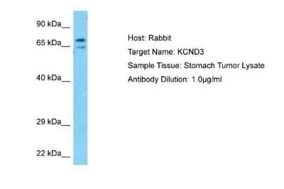 Western Blot: Kv4.3 Antibody [NBP2-87708] - Host: Rabbit. Target Name: KCND3. Sample Type: Stomach Tumor lysates. Antibody Dilution: 1.0ug/ml