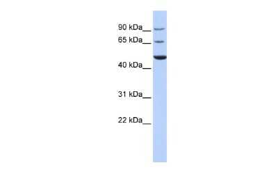 Western Blot: Kv4.3 Antibody [NBP2-87709] - WB Suggested Anti-KCND3 Antibody Titration: 0.2-1 ug/ml. ELISA Titer: 1:1562500. Positive Control: HepG2 cell lysate