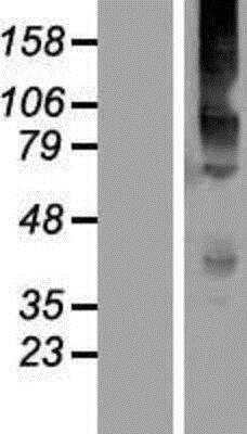 Western Blot: Kv6.4 Overexpression Lysate (Native) [NBP2-05161] - Kv6.4 Overexpression Lysate (Native) Left-Empty vector transfected control cell lysate (HEK293 cell lysate); Right -Over-expression Lysate for KCNG4.