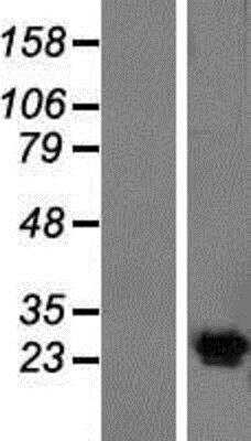 Western Blot: Kv6.4 Overexpression Lysate (Native) [NBP2-05703] - Kv6.4 Overexpression Lysate (Native) Left-Empty vector transfected control cell lysate (HEK293 cell lysate); Right -Over-expression Lysate for KCNG4.