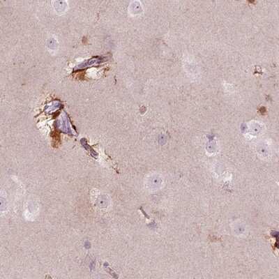 Immunohistochemistry-Paraffin Kv6.2 Antibody