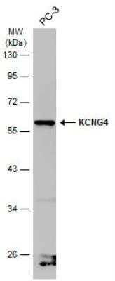 Western Blot Kv6.4 Antibody