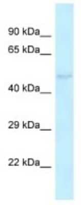 Western Blot: Kv6.4 Antibody [NBP3-10369] - Western blot analysis of Kv6.4 in Rat Liver lysates. Antibody dilution at 1.0ug/ml