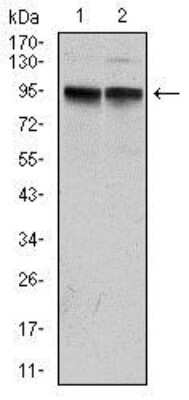 Western Blot: Kv7.1 Antibody (5E12) [NBP2-37538] - Western blot analysis using KCNQ1 mouse mAb against MCF-7 (1) and A431 (2) cell lysate.