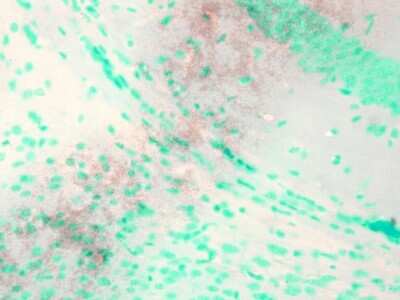 Immunohistochemistry: Kv7.1 Antibody (S37A/10) [NBP2-12897] - Immunohistochemistry analysis using Mouse Anti-Kv7.1 Monoclonal Antibody, Clone N37A/10 (NBP2-12897). Tissue: Brain Slice. Species: Mouse. Fixation: 10% Formalin Solution for 12-24 hours at RT. Primary Antibody: Mouse Anti-Kv7.1 Monoclonal Antibody (NBP2-12897) at 1:1000 for 1 hour at RT. Secondary Antibody: HRP/DAB Detection System: Biotinylated Goat Anti-Mouse, Streptavidin Peroxidase, DAB Chromogen (brown) for 30 minutes at RT. Counterstain: Mayer Hematoxylin (purple/blue) nuclear stain at 250-500 l for 5 minutes at RT.