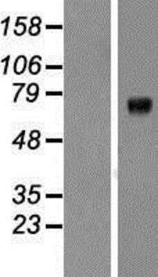 Western Blot: Kv7.1 Overexpression Lysate (Native) [NBP2-04880] - Kv7.1 Overexpression Lysate (Native) Left-Empty vector transfected control cell lysate (HEK293 cell lysate); Right -Over-expression Lysate for KCNQ1.