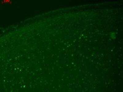 Immunohistochemistry: Kv7.2 Antibody (S26A-23) [NBP2-12898] - Human hippocampal tissues.