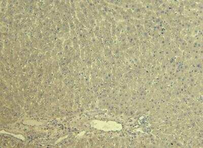 Control: Kv7.1 Antibody [NBP1-30119] - Negative Control showing staining of paraffin embedded Rat Liver, with no primary antibody.