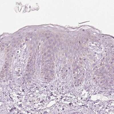 Immunohistochemistry-Paraffin: Kv7.1 Antibody [NBP2-31876] - Staining of human skin shows low expression as expected.