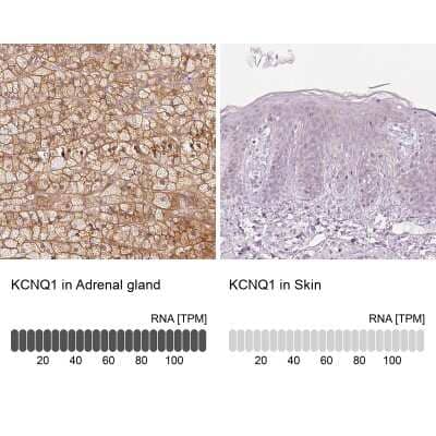 <b>Orthogonal Strategies Validation. </b>Immunohistochemistry-Paraffin: Kv7.1 Antibody [NBP2-31876] - Staining in human adrenal gland and skin tissues using anti-KCNQ1 antibody. Corresponding KCNQ1 RNA-seq data are presented for the same tissues.