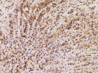 Immunohistochemistry-Paraffin: Kv7.1 Antibody [NBP2-97900] - Immunochemical staining of human Kv7.1 in human adrenal gland with rabbit polyclonal antibody at 1:100 dilution, formalin-fixed paraffin embedded sections.