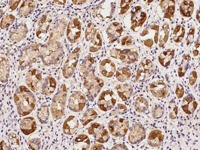 Immunohistochemistry-Paraffin: Kv7.1 Antibody [NBP2-97900] - Immunochemical staining of human Kv7.1 in human stomach with rabbit polyclonal antibody at 1:100 dilution, formalin-fixed paraffin embedded sections.