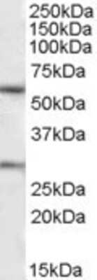 Western Blot: Kv7.1 Antibody [NBP1-30119] - Analysis of Kv7.1 in Human Heart lysate (35ug protein in RIPA buffer) using NBP1-30119 at 1 ug/ml. Primary incubation was 1 hour. Detected by chemiluminescence.