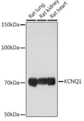 Western Blot: Kv7.1 Antibody [NBP3-03610] - Analysis of extracts of various cell lines, using KCNQ1 Rabbit pAb  at 1:1000 dilution. Secondary antibody: HRP Goat Anti-Rabbit IgG (H+L) at 1:10000 dilution.Lysates/proteins: 25ug per lane. Blocking buffer: 3% nonfat dry milk in TBST.Detection: ECL Enhanced Kit. Exposure time: 10s.