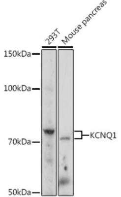 Western Blot: Kv7.1 Antibody [NBP3-03610] - Analysis of extracts of various cell lines, using KCNQ1 Rabbit pAb at 1:1000 dilution.Secondary antibody: HRP Goat Anti-Rabbit IgG (H+L)  at 1:10000 dilution.Lysates/proteins: 25ug per lane. Blocking buffer: 3% nonfat dry milk in TBST.Detection: ECL Enhanced Kit. Exposure time: 30s.