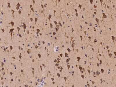 Immunohistochemistry-Paraffin: Kv7.5 Antibody [NBP2-98067] - Staining of human Kv7.5 in human brain with rabbit polyclonal antibody at 1:100 dilution. 