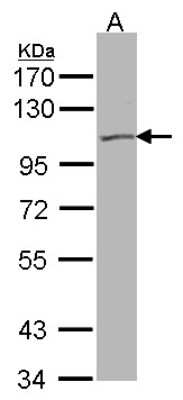 Western Blot: Kv7.5 Antibody [NBP1-32309] - Sample(30 ug of whole cell lysate)A:293T7. 5% SDS PAGE, antibody diluted at 1:500.