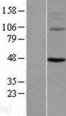 Western Blot Kv8.1 Overexpression Lysate