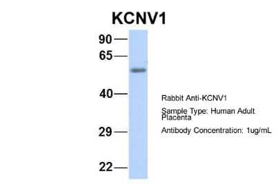 Western Blot Kv8.1 Antibody - BSA Free