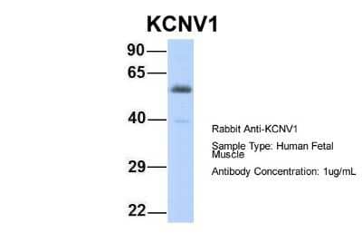 Western Blot: Kv8.1 Antibody [NBP2-84129] - Host: Rabbit. Target Name: KCNV1. Sample Type: Human Fetal Muscle. Antibody Dilution: 1.0ug/ml