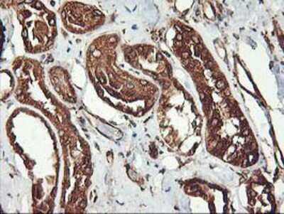 Immunohistochemistry-Paraffin: KvBeta1.1 Antibody (4E7) [NBP2-01526] - Staining of paraffin-embedded Human Kidney tissue using anti-KvBeta1.1 mouse monoclonal antibody.