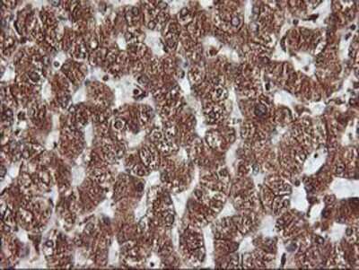 Immunohistochemistry-Paraffin: KvBeta1.1 Antibody (4E7) [NBP2-01526] - Staining of paraffin-embedded Human liver tissue using anti-KvBeta1.1 mouse monoclonal antibody.