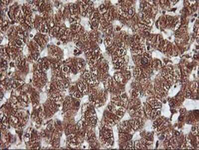 Immunohistochemistry-Paraffin: KvBeta1.1 Antibody (4E7) [NBP2-01526] - Staining of paraffin-embedded Human liver tissue using anti-KvBeta1.1 mouse monoclonal antibody.