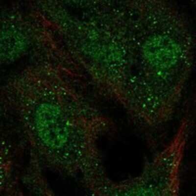 Immunocytochemistry/Immunofluorescence: KvBeta1 Antibody [NBP3-17876] - Staining of human cell line HUVEC TERT2 shows localization to nucleoplasm, plasma membrane & vesicles.