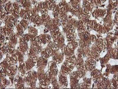 Immunohistochemistry: KvBeta1 Antibody (OTI4E7) - Azide and BSA Free [NBP2-71344] - Staining of paraffin-embedded Human liver tissue using anti-KvBeta1.1 mouse monoclonal antibody.