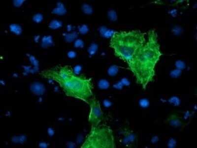 Immunocytochemistry/Immunofluorescence: KvBeta1 Antibody (OTI7F12) - Azide and BSA Free [NBP2-71349] - Analysis of COS7 cells transiently transfected by pCMV6-ENTRY KvBeta1.